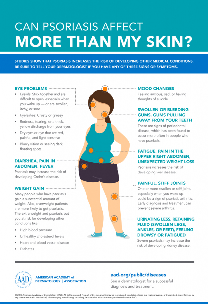 surgery in patients with psoriasis